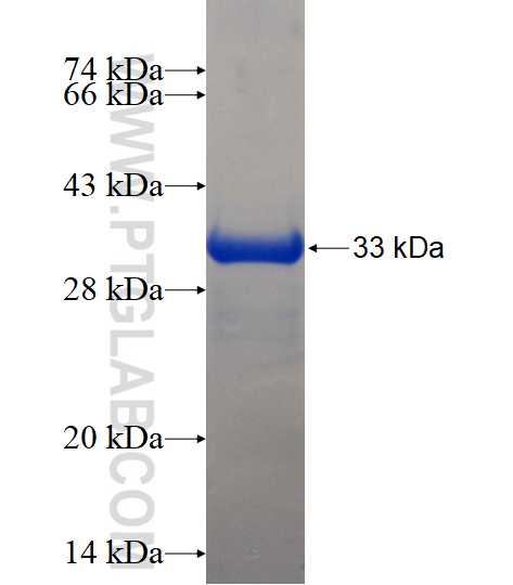 S100A11 fusion protein Ag0343 SDS-PAGE