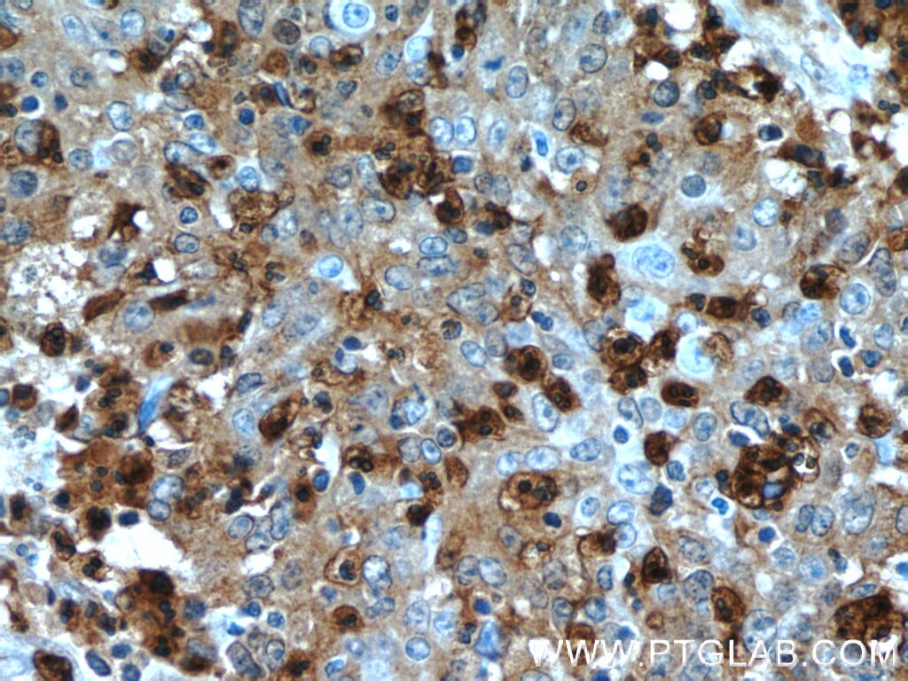 S100A12 Polyclonal antibody