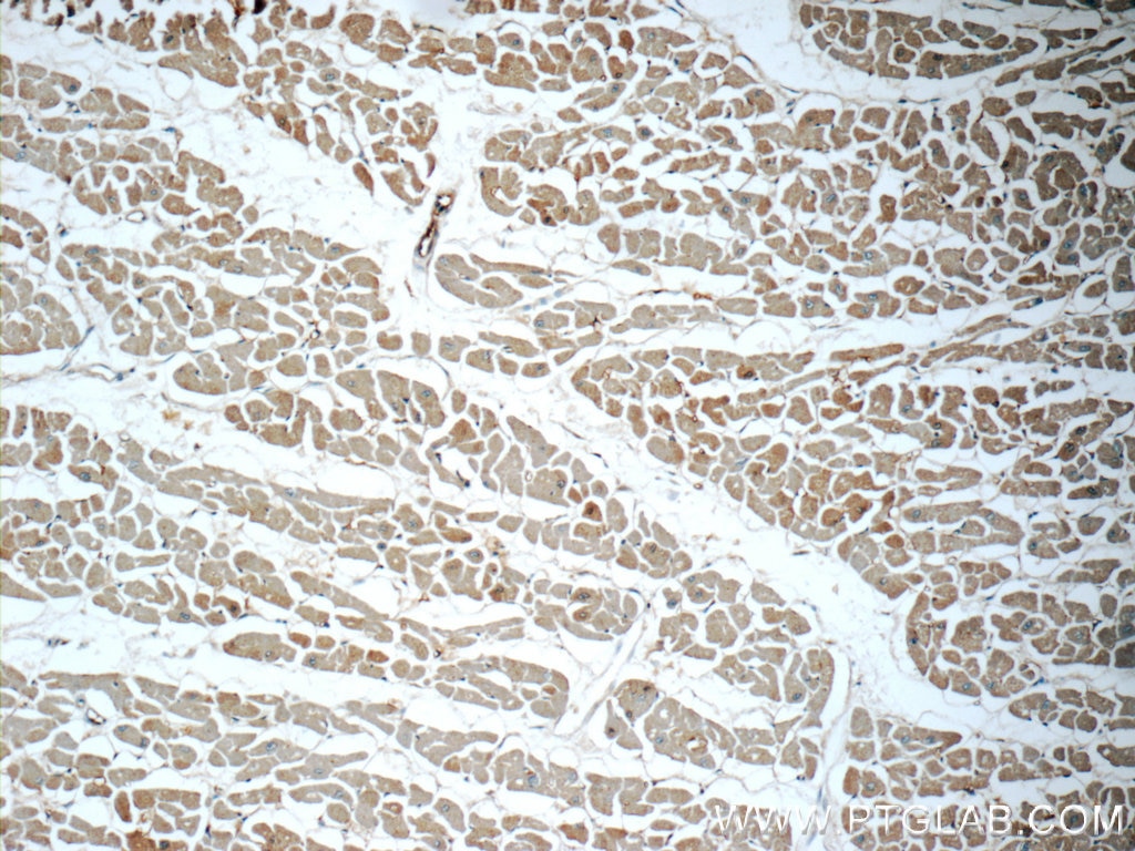 Immunohistochemistry (IHC) staining of human heart tissue using S100A13 Polyclonal antibody (14987-1-AP)