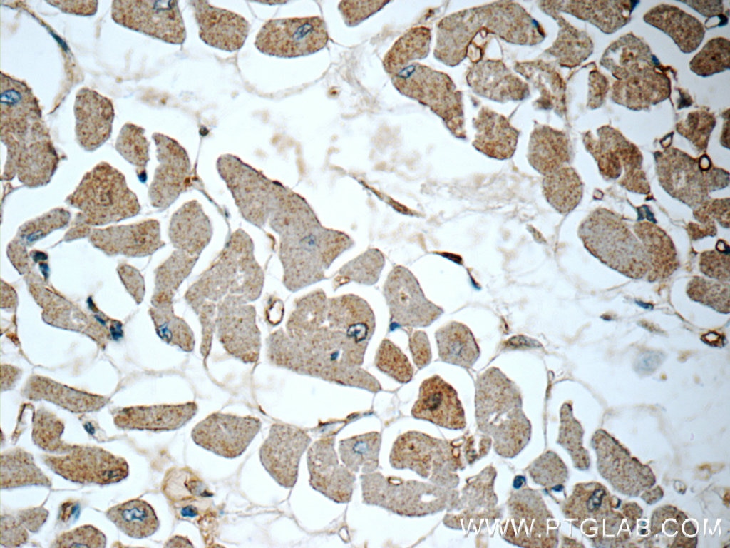 Immunohistochemistry (IHC) staining of human heart tissue using S100A13 Polyclonal antibody (14987-1-AP)