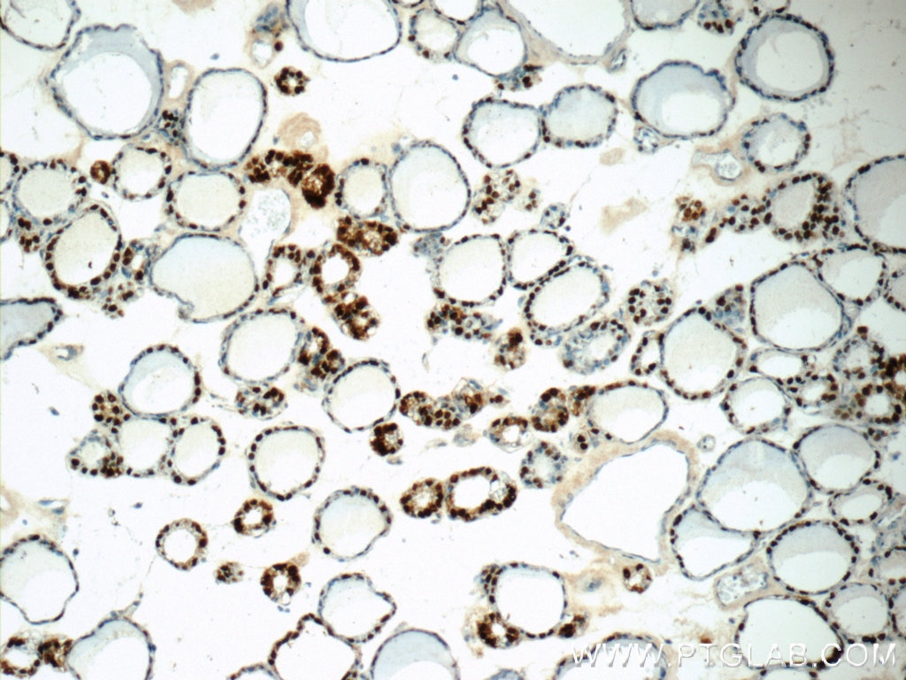 Immunohistochemistry (IHC) staining of human thyroid tissue using S100A13 Polyclonal antibody (14987-1-AP)