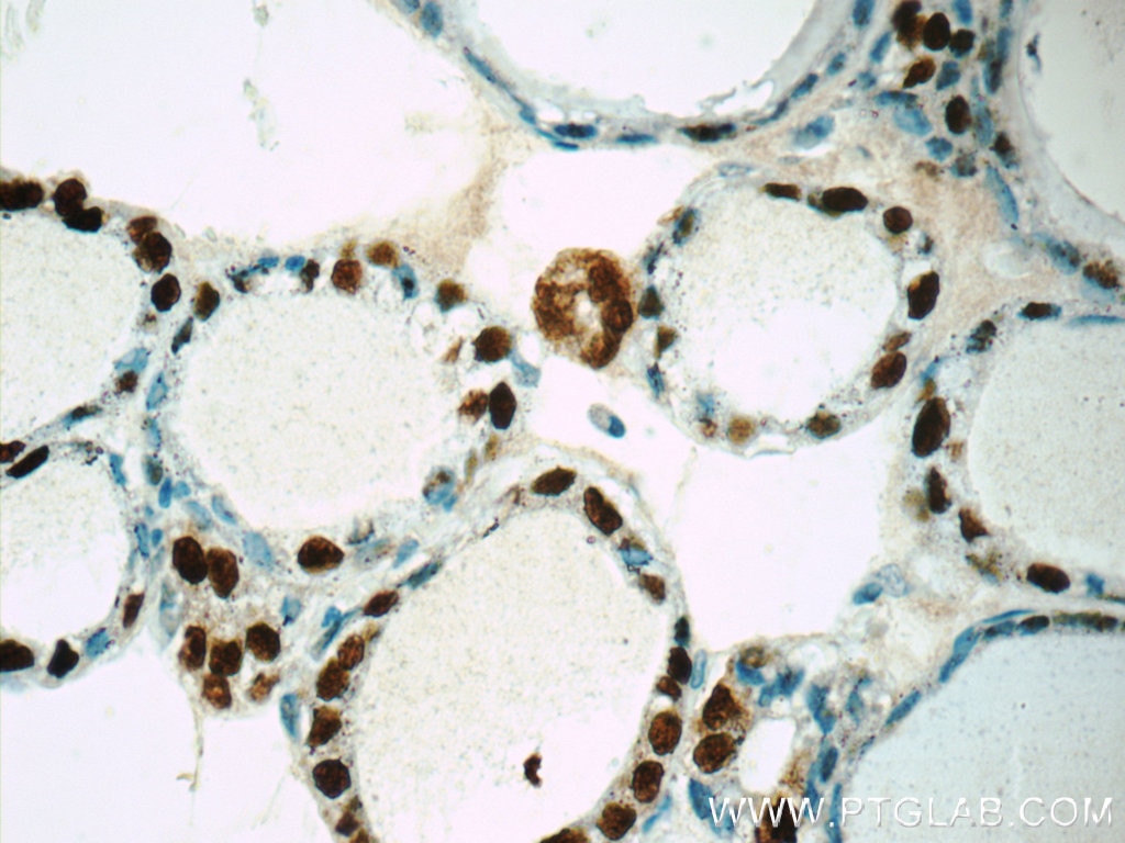 Immunohistochemistry (IHC) staining of human thyroid tissue using S100A13 Polyclonal antibody (14987-1-AP)