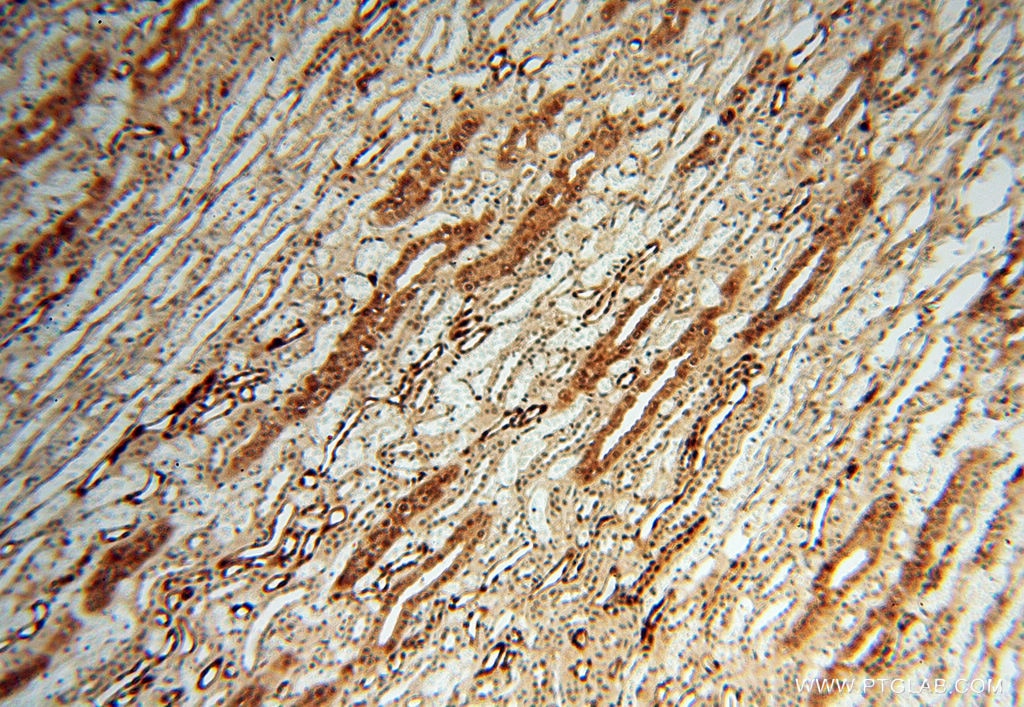 Immunohistochemistry (IHC) staining of human kidney tissue using S100A13 Polyclonal antibody (14987-1-AP)