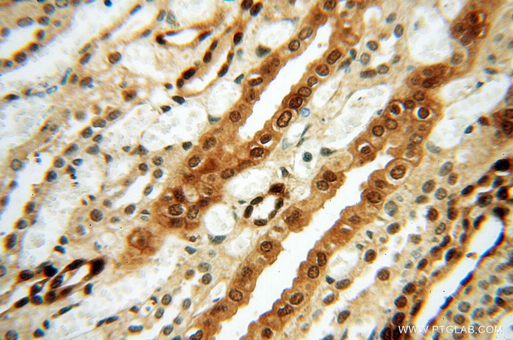 Immunohistochemistry (IHC) staining of human kidney tissue using S100A13 Polyclonal antibody (14987-1-AP)