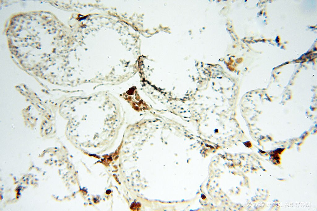 Immunohistochemistry (IHC) staining of human testis tissue using S100A13 Polyclonal antibody (14987-1-AP)