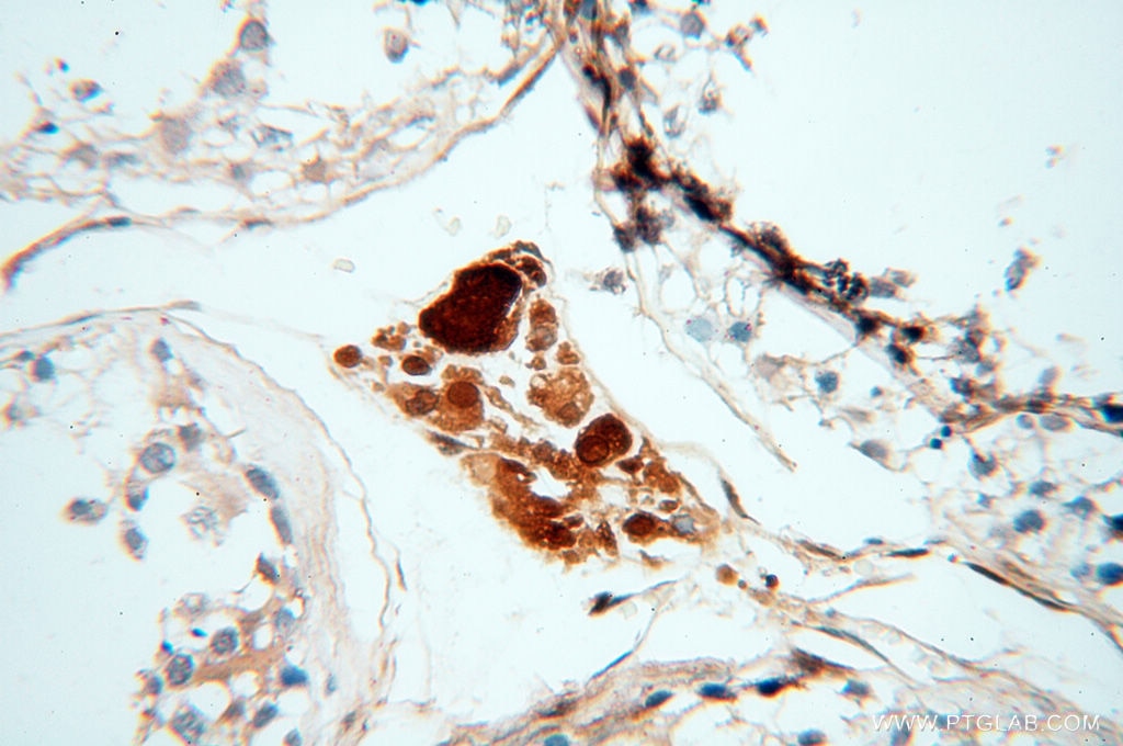 Immunohistochemistry (IHC) staining of human testis tissue using S100A13 Polyclonal antibody (14987-1-AP)