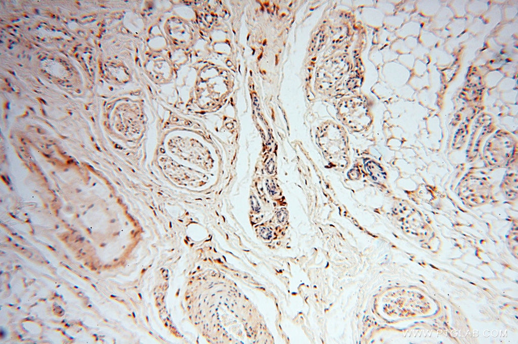 Immunohistochemistry (IHC) staining of human skin tissue using S100A13 Polyclonal antibody (14987-1-AP)