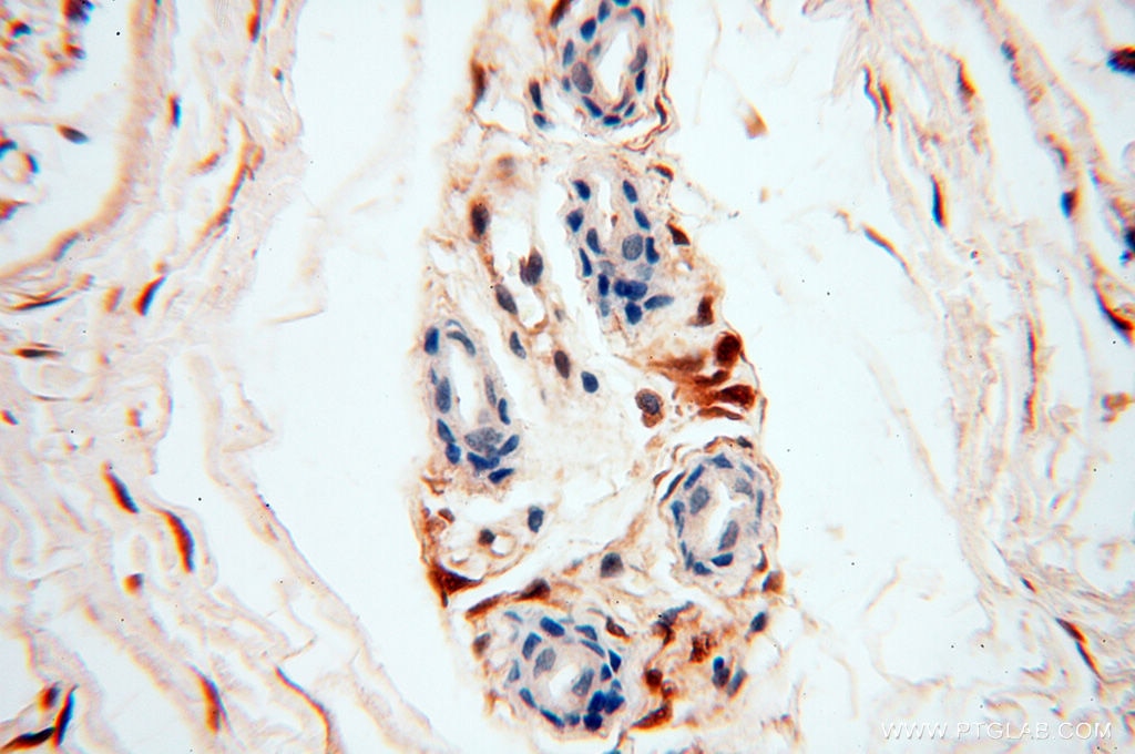Immunohistochemistry (IHC) staining of human skin tissue using S100A13 Polyclonal antibody (14987-1-AP)