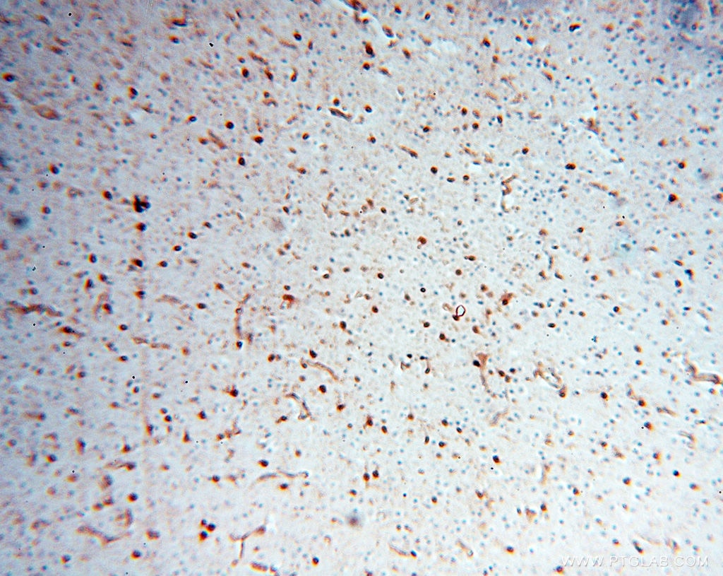 Immunohistochemistry (IHC) staining of human brain tissue using S100A13 Polyclonal antibody (14987-1-AP)