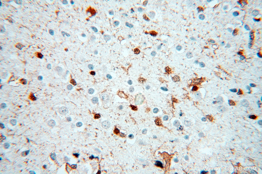 Immunohistochemistry (IHC) staining of human brain tissue using S100A13 Polyclonal antibody (14987-1-AP)
