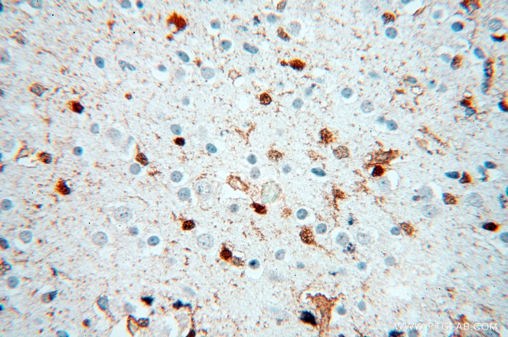 Immunohistochemistry (IHC) staining of human brain tissue using S100A13 Polyclonal antibody (14987-1-AP)