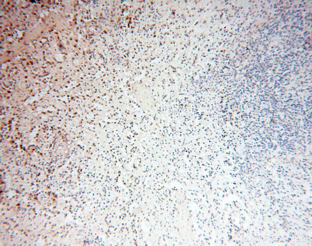 Immunohistochemistry (IHC) staining of human spleen tissue using S100A13 Polyclonal antibody (14987-1-AP)