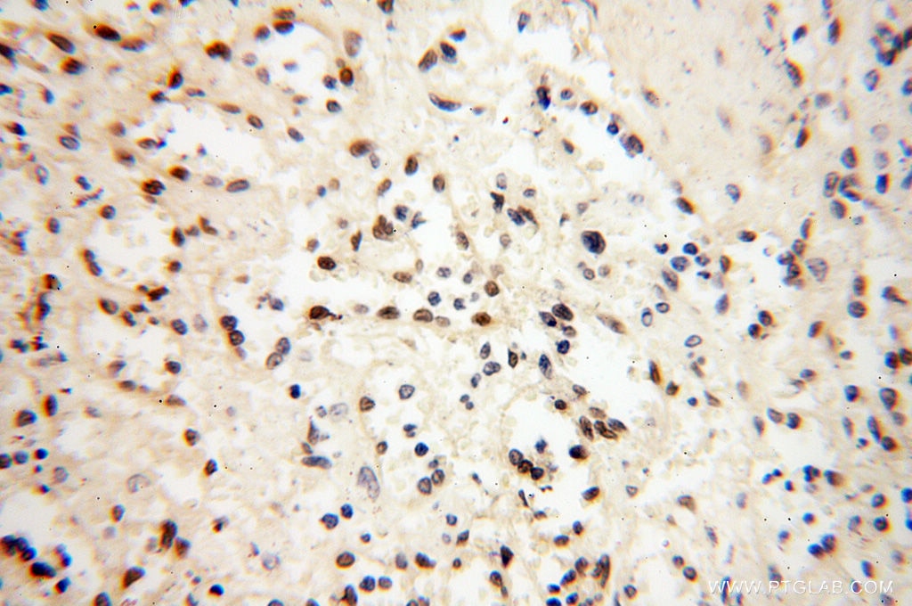 Immunohistochemistry (IHC) staining of human spleen tissue using S100A13 Polyclonal antibody (14987-1-AP)