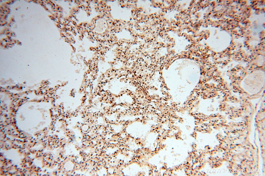 Immunohistochemistry (IHC) staining of human lung tissue using S100A13 Polyclonal antibody (14987-1-AP)