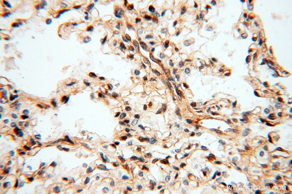 Immunohistochemistry (IHC) staining of human lung tissue using S100A13 Polyclonal antibody (14987-1-AP)