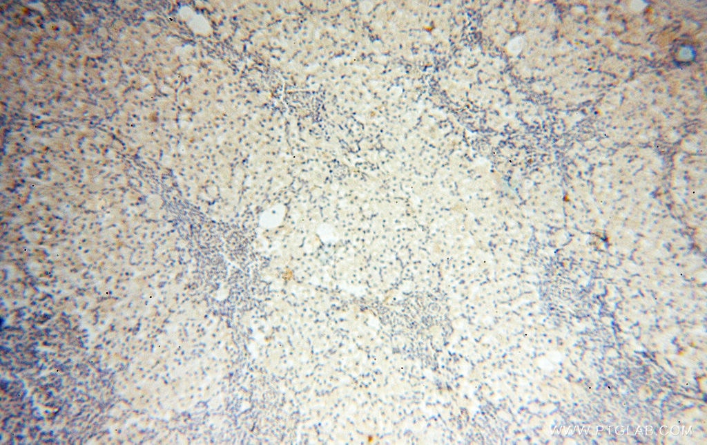 Immunohistochemistry (IHC) staining of human ovary tissue using S100A13 Polyclonal antibody (14987-1-AP)