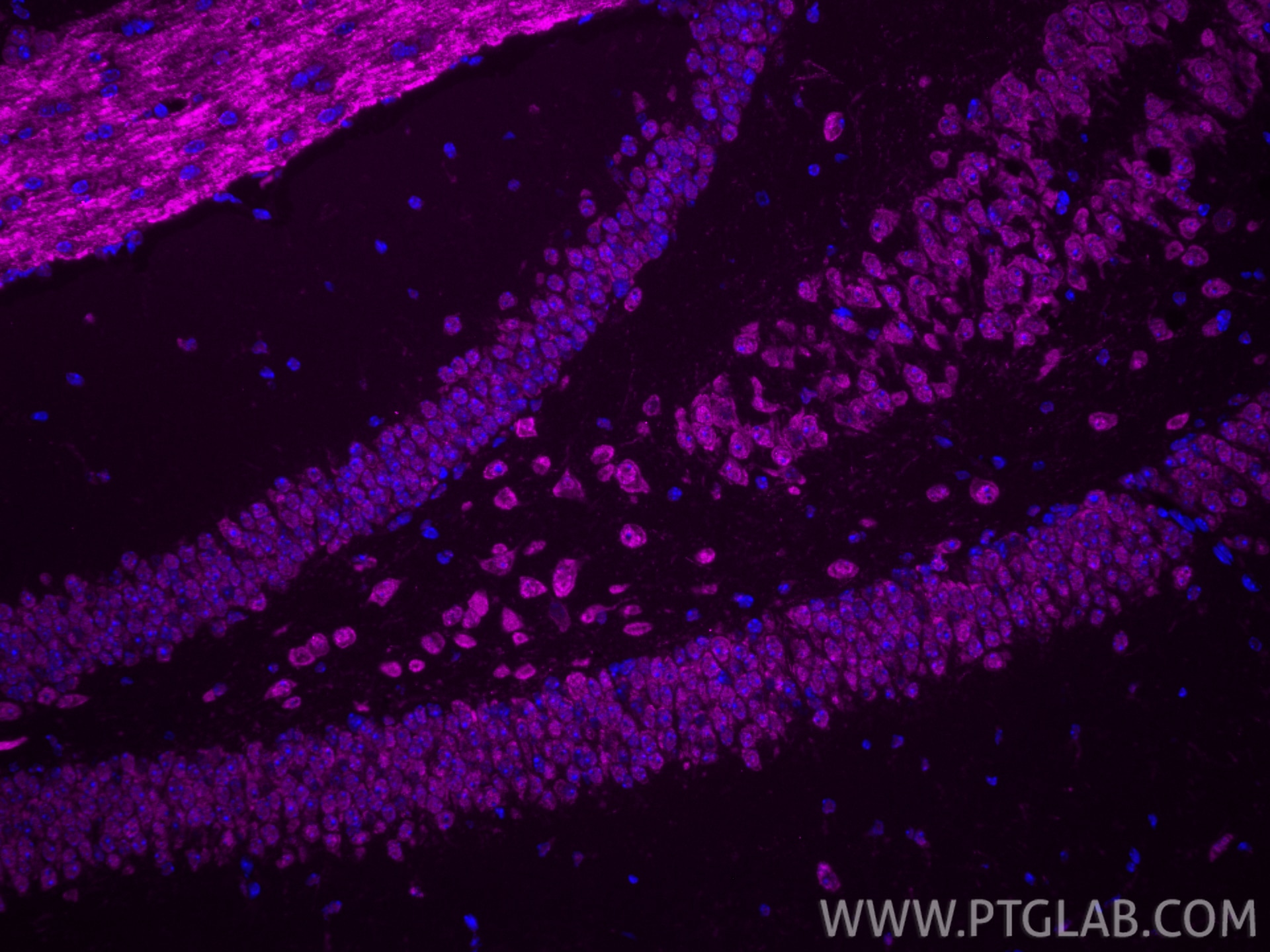 Immunofluorescence (IF) / fluorescent staining of mouse brain tissue using CoraLite® Plus 647-conjugated S100A13 Polyclonal a (CL647-14987)