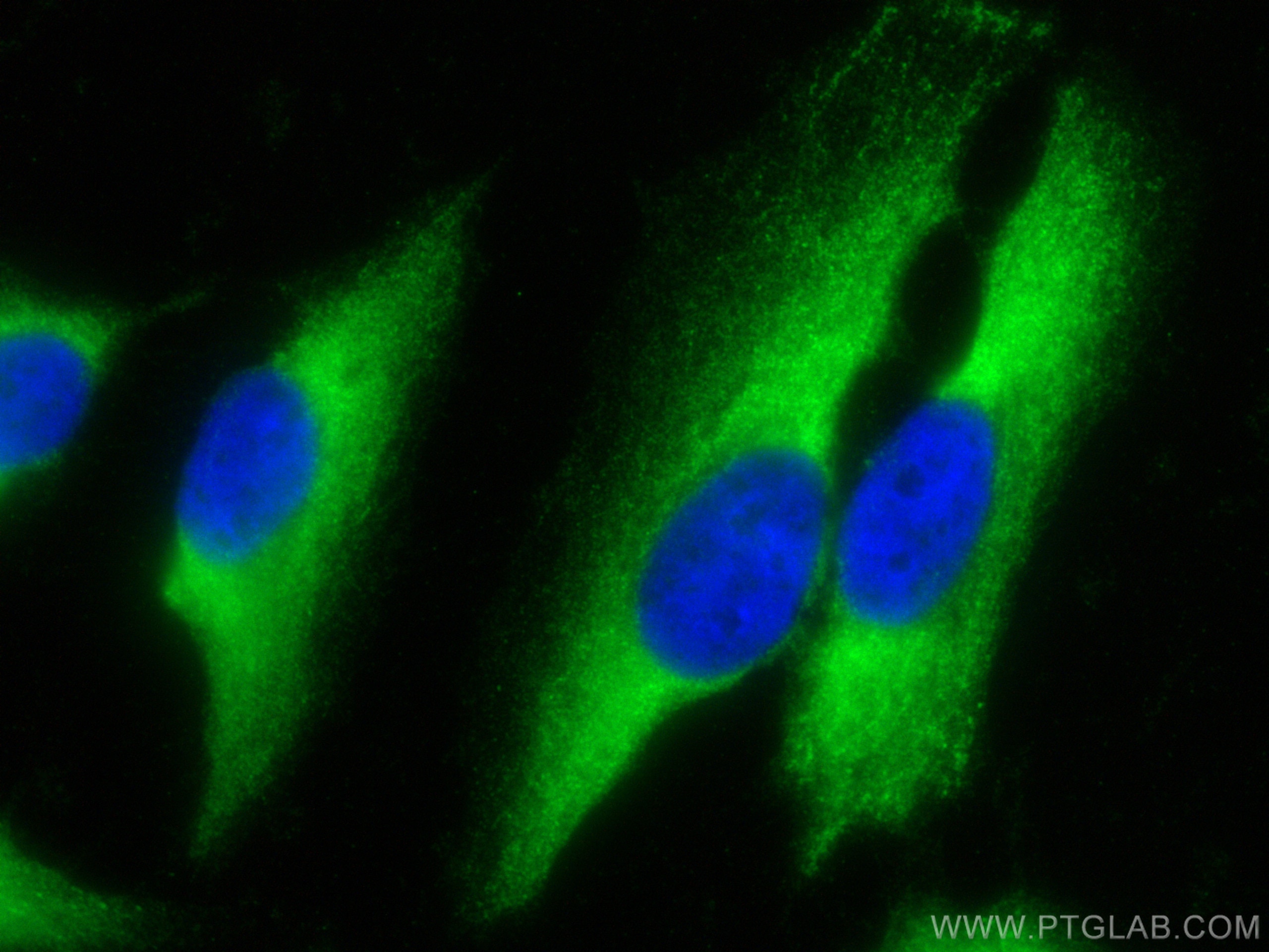Immunofluorescence (IF) / fluorescent staining of HeLa cells using S100A14 Polyclonal antibody (10489-1-AP)