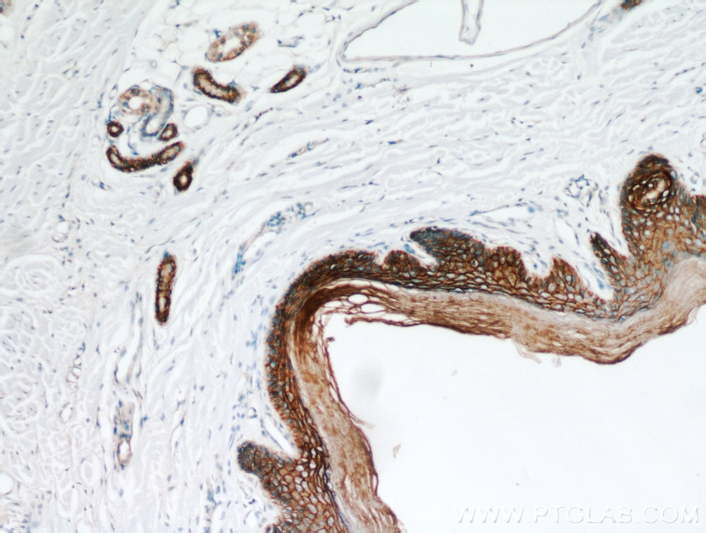 Immunohistochemistry (IHC) staining of human skin tissue using S100A14 Polyclonal antibody (10489-1-AP)