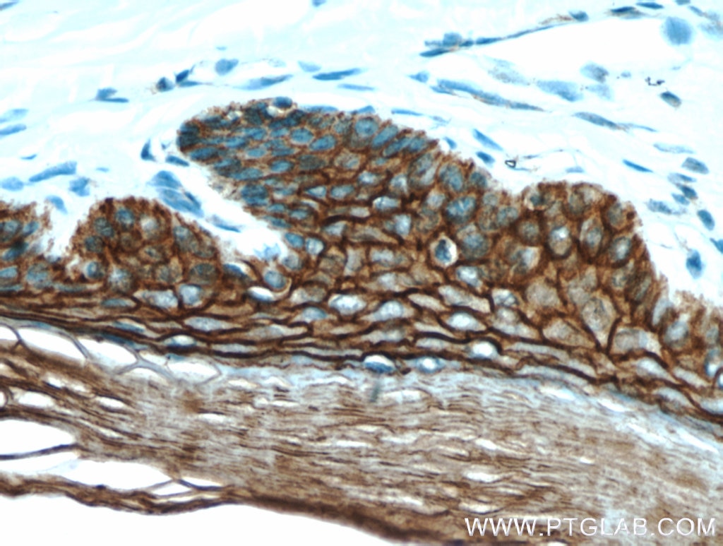 Immunohistochemistry (IHC) staining of human skin tissue using S100A14 Polyclonal antibody (10489-1-AP)