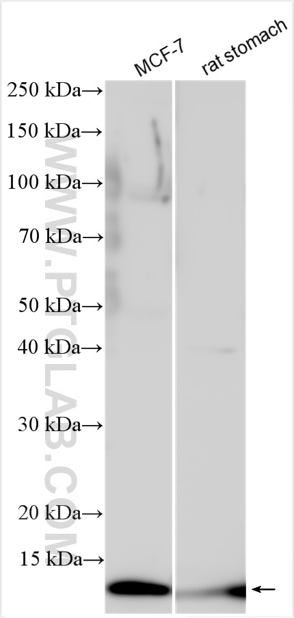 Western Blot (WB) analysis of various lysates using S100A14 Polyclonal antibody (10489-1-AP)
