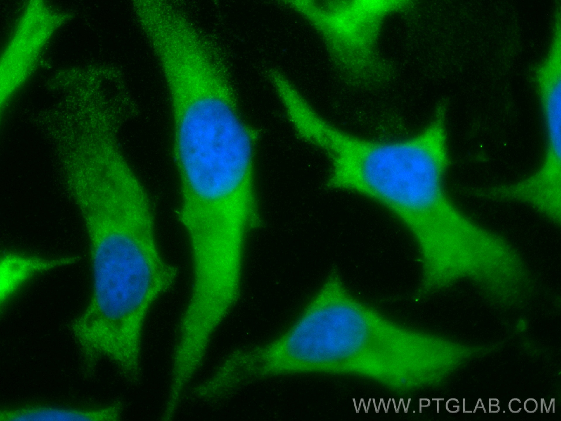 Immunofluorescence (IF) / fluorescent staining of HeLa cells using CoraLite® Plus 488-conjugated S100A14 Polyclonal a (CL488-10489)