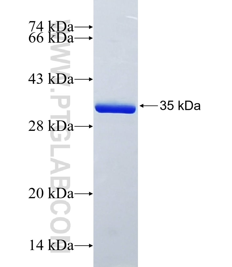 S100A14 fusion protein Ag0757 SDS-PAGE