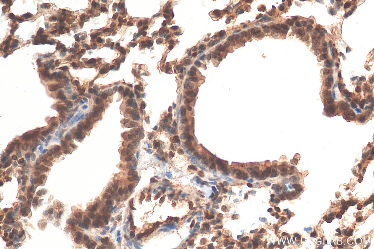Immunohistochemistry (IHC) staining of mouse lung tissue using S100A16 Polyclonal antibody (11456-1-AP)