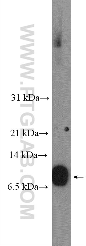 Western Blot (WB) analysis of A431 cells using S100A16 Polyclonal antibody (11456-1-AP)