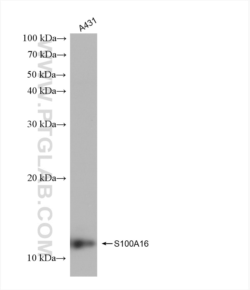 Western Blot (WB) analysis of A431 cells using S100A16 Recombinant antibody (82923-1-RR)