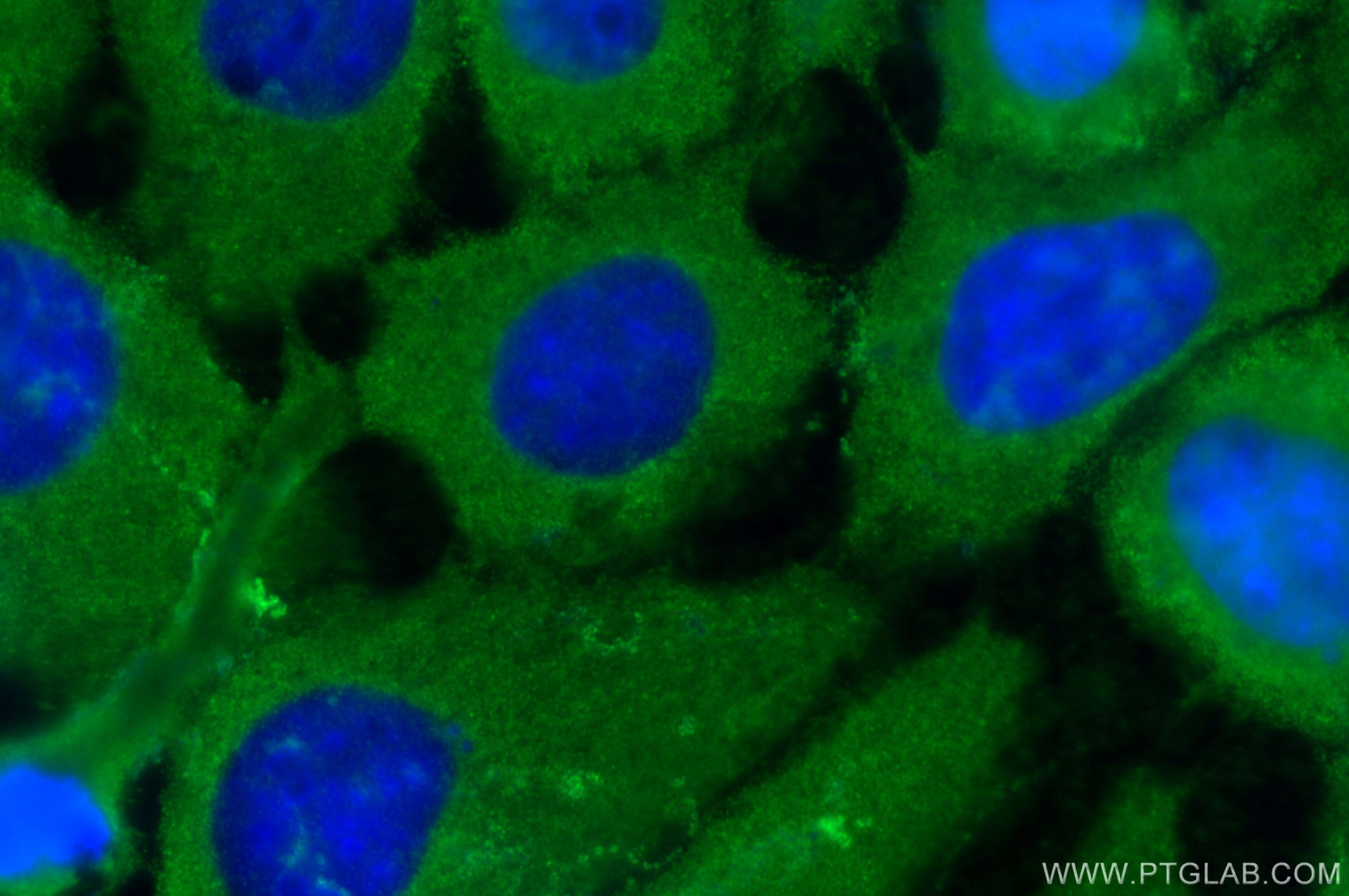 Immunofluorescence (IF) / fluorescent staining of A431 cells using S100A2 Polyclonal antibody (15454-1-AP)