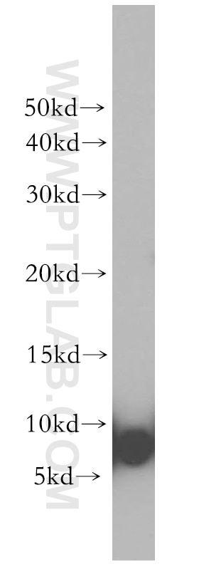 Western Blot (WB) analysis of A2780 cells using S100A3 Polyclonal antibody (12343-1-AP)