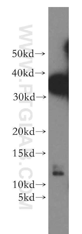 Western Blot (WB) analysis of HeLa cells using S100A3 Polyclonal antibody (12343-1-AP)