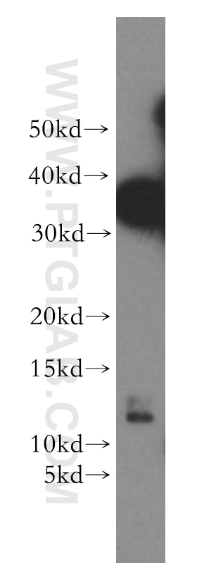 WB analysis of HeLa using 12343-1-AP