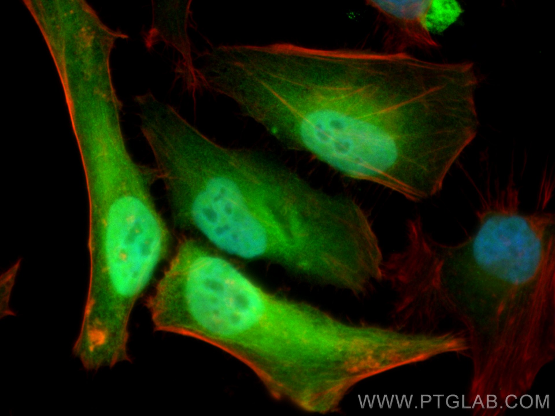 Immunofluorescence (IF) / fluorescent staining of HeLa cells using S100A4 Polyclonal antibody (16105-1-AP)