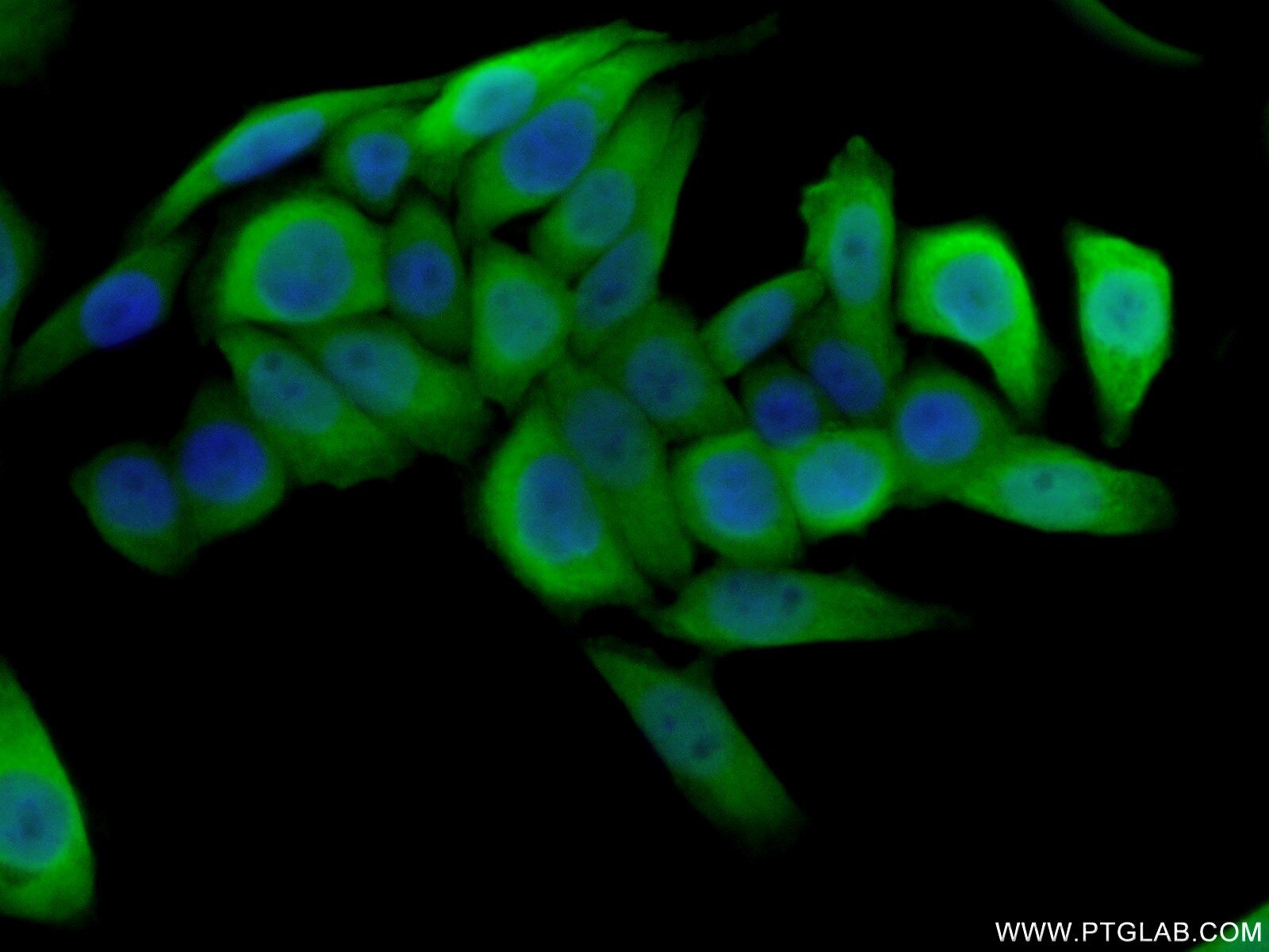 Immunofluorescence (IF) / fluorescent staining of HeLa cells using S100A4 Polyclonal antibody (16105-1-AP)