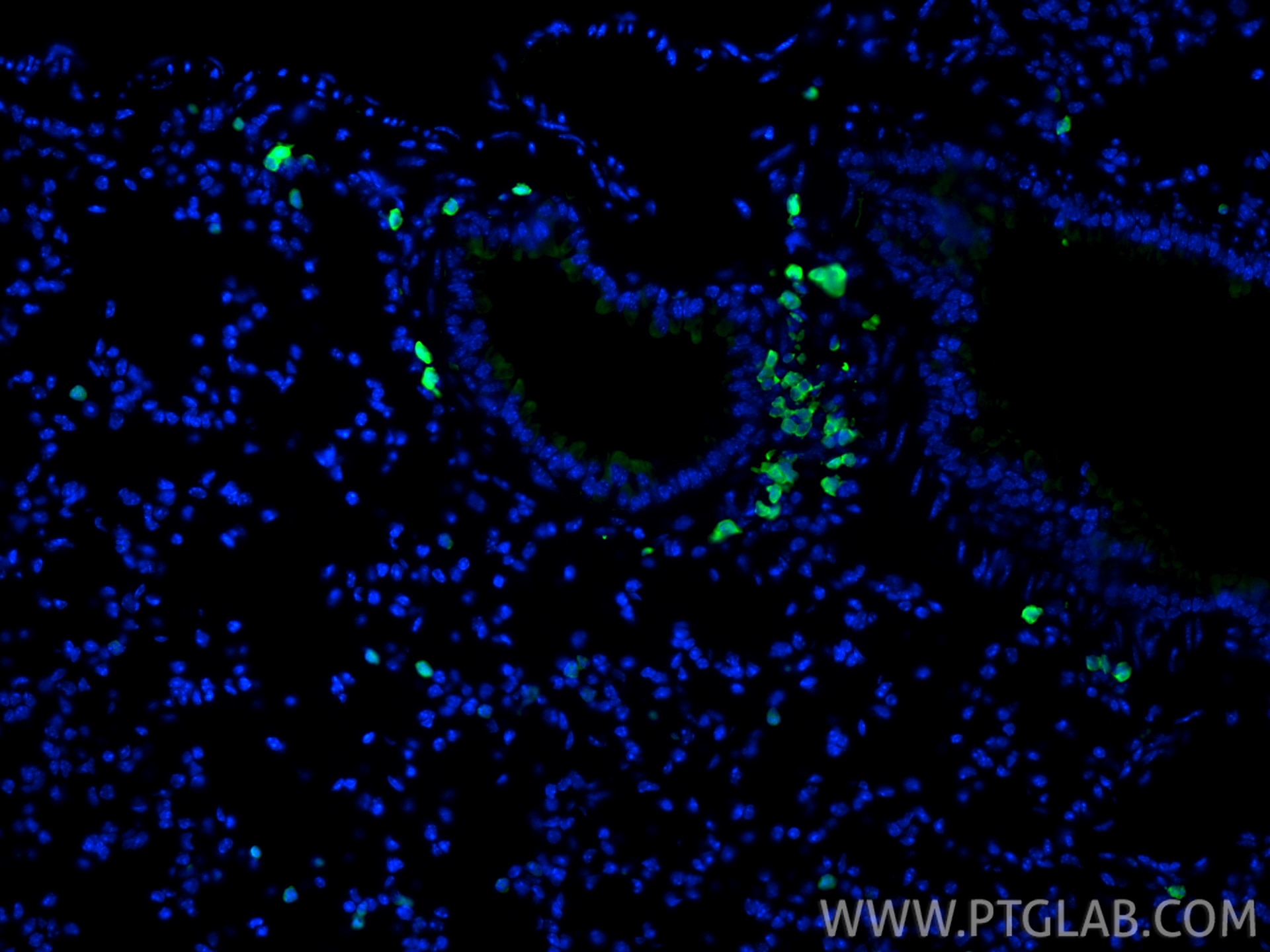 Immunofluorescence (IF) / fluorescent staining of mouse lung tissue using S100A4 Polyclonal antibody (16105-1-AP)