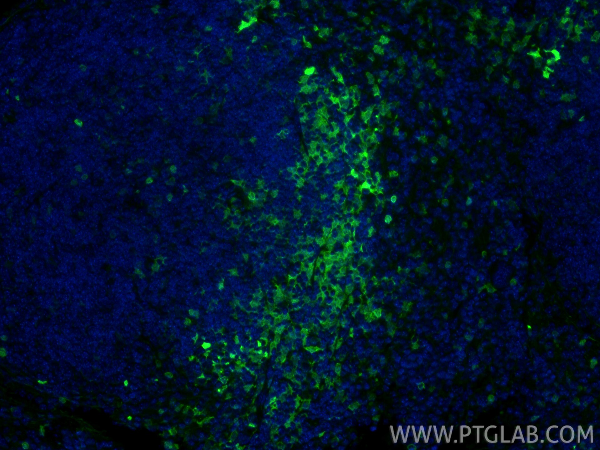 Immunofluorescence (IF) / fluorescent staining of mouse spleen tissue using S100A4 Polyclonal antibody (16105-1-AP)