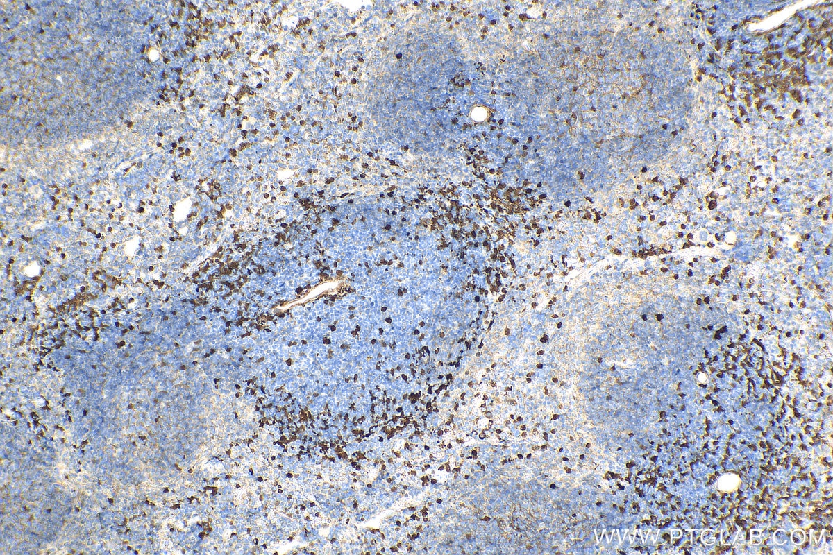 Immunohistochemistry (IHC) staining of mouse spleen tissue using S100A4 Polyclonal antibody (16105-1-AP)