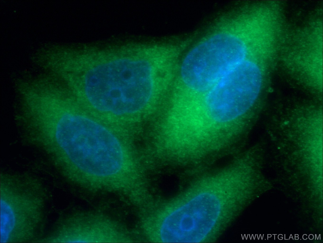 Immunofluorescence (IF) / fluorescent staining of HeLa cells using S100A4 Monoclonal antibody (66489-1-Ig)