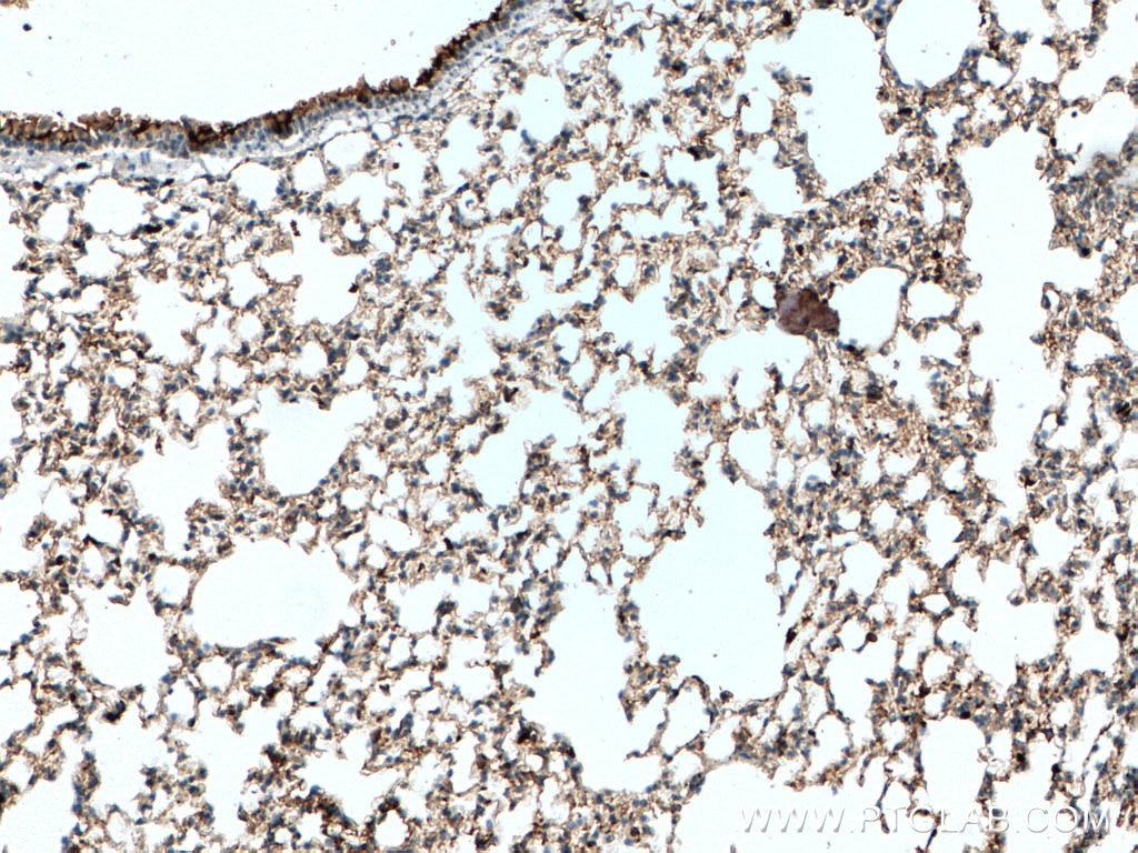 Immunohistochemistry (IHC) staining of mouse lung tissue using S100A4 Monoclonal antibody (66489-1-Ig)