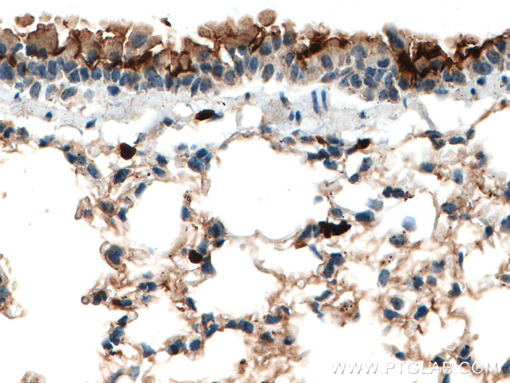 Immunohistochemistry (IHC) staining of mouse lung tissue using S100A4 Monoclonal antibody (66489-1-Ig)