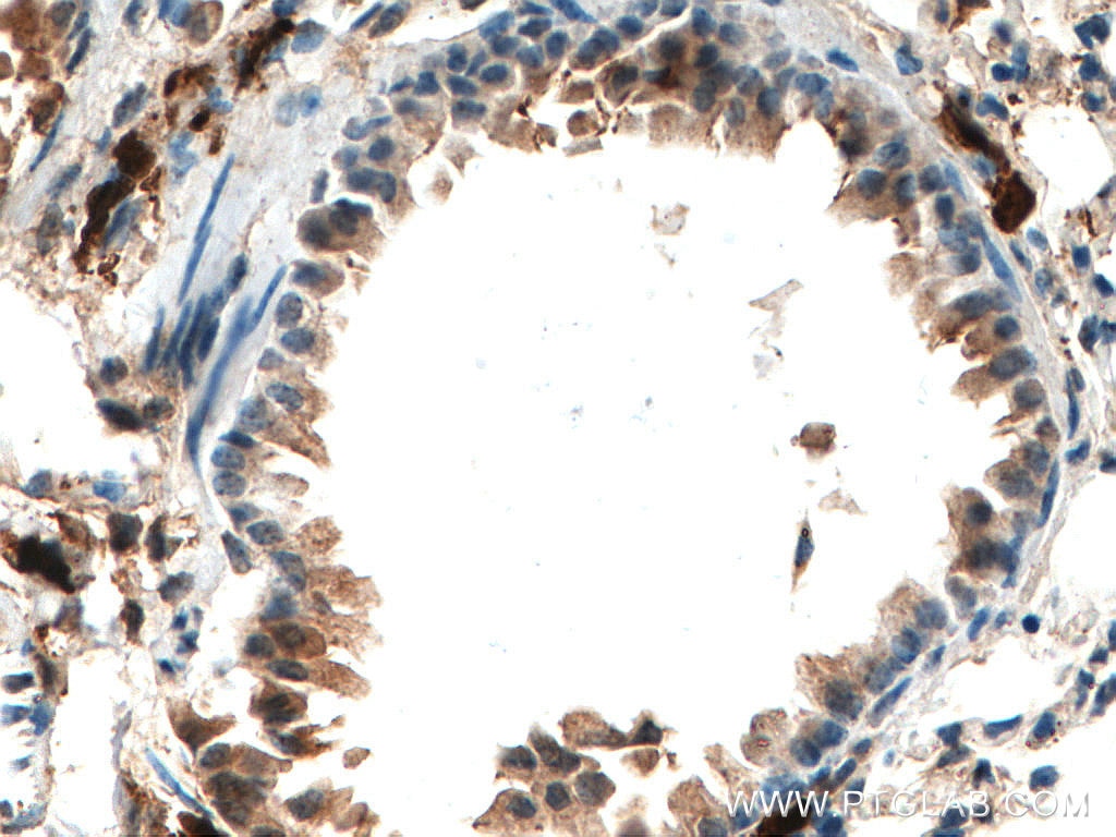 Immunohistochemistry (IHC) staining of mouse lung tissue using S100A4 Monoclonal antibody (66489-1-Ig)