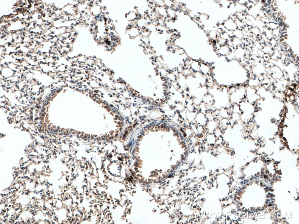 Immunohistochemistry (IHC) staining of mouse lung tissue using S100A4 Monoclonal antibody (66489-1-Ig)