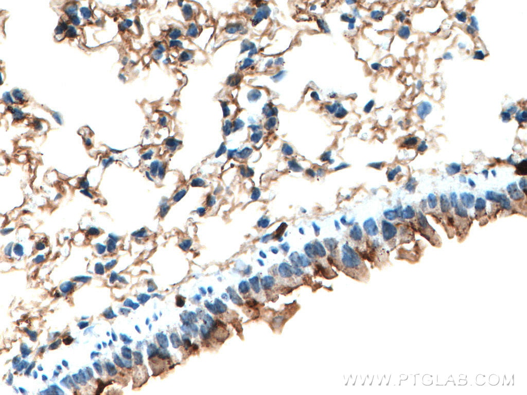 Immunohistochemistry (IHC) staining of mouse lung tissue using S100A4 Monoclonal antibody (66489-1-Ig)