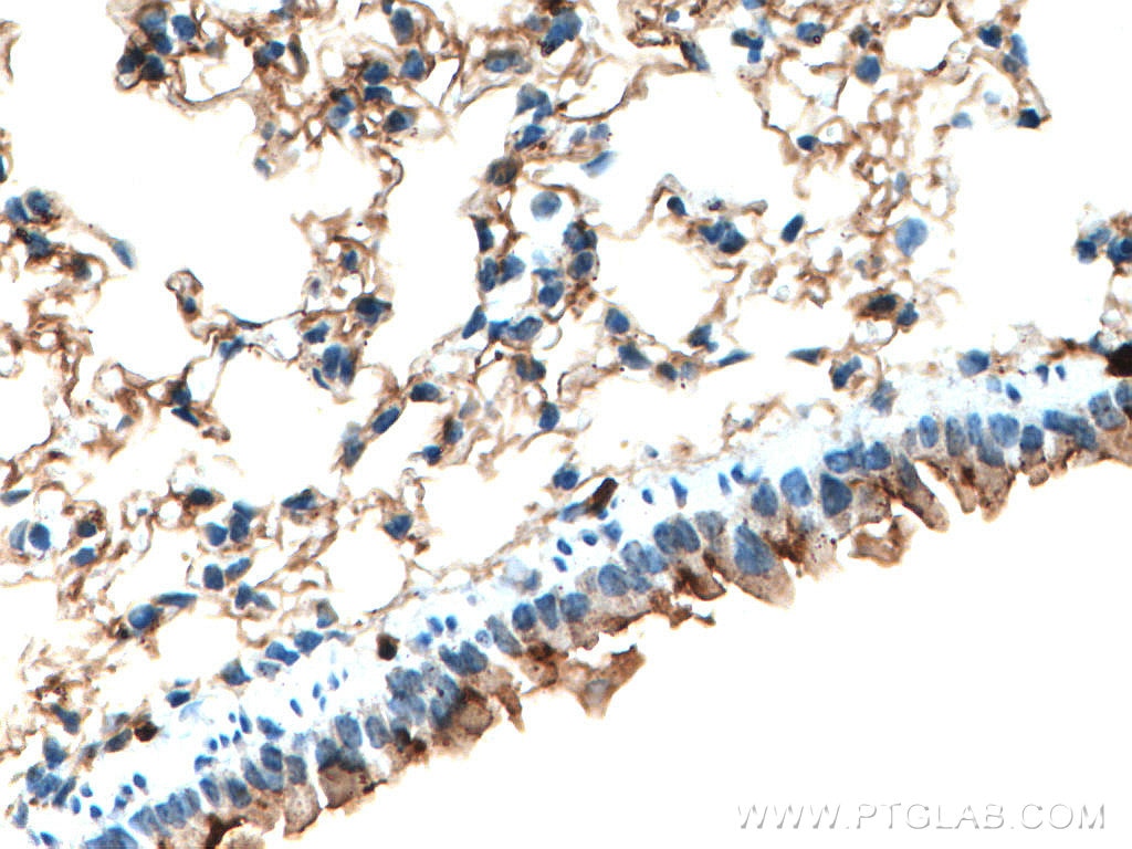 IHC staining of mouse lung using 66489-1-Ig