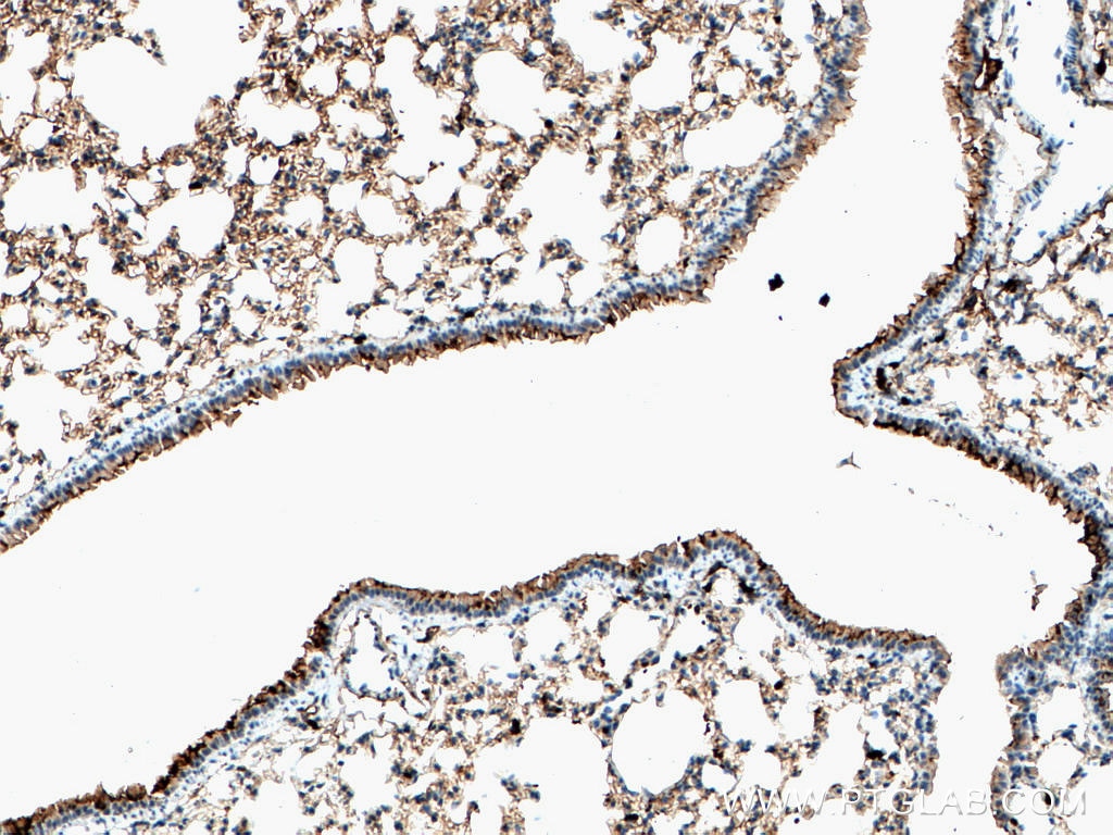 Immunohistochemistry (IHC) staining of mouse lung tissue using S100A4 Monoclonal antibody (66489-1-Ig)