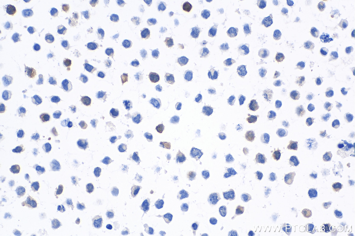 Immunohistochemistry (IHC) staining of K-562 cells using S100A4 Monoclonal antibody (66489-1-Ig)