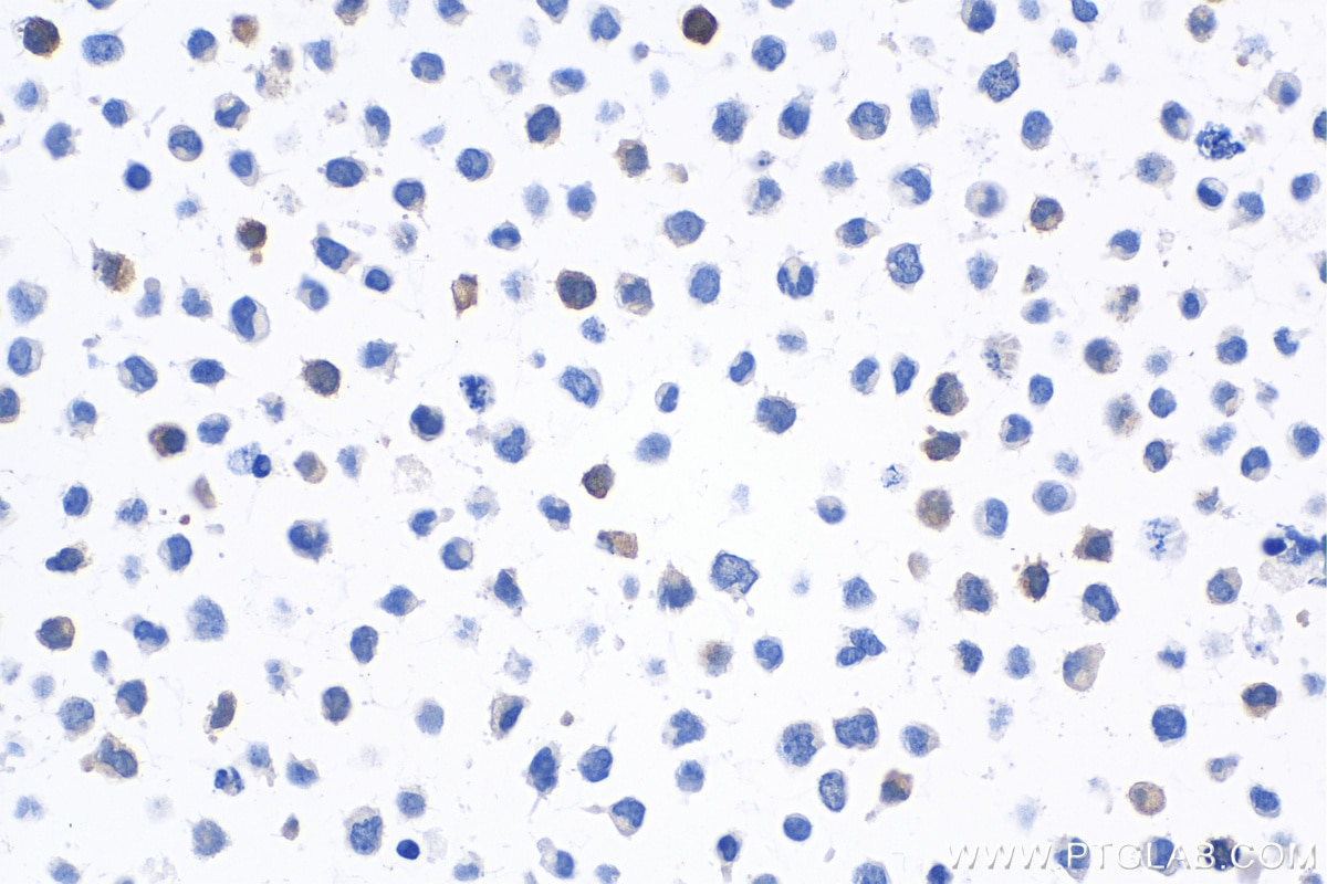 IHC staining of K-562 using 66489-1-Ig