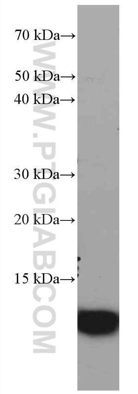 Western Blot (WB) analysis of HeLa cells using S100A4 Monoclonal antibody (66489-1-Ig)